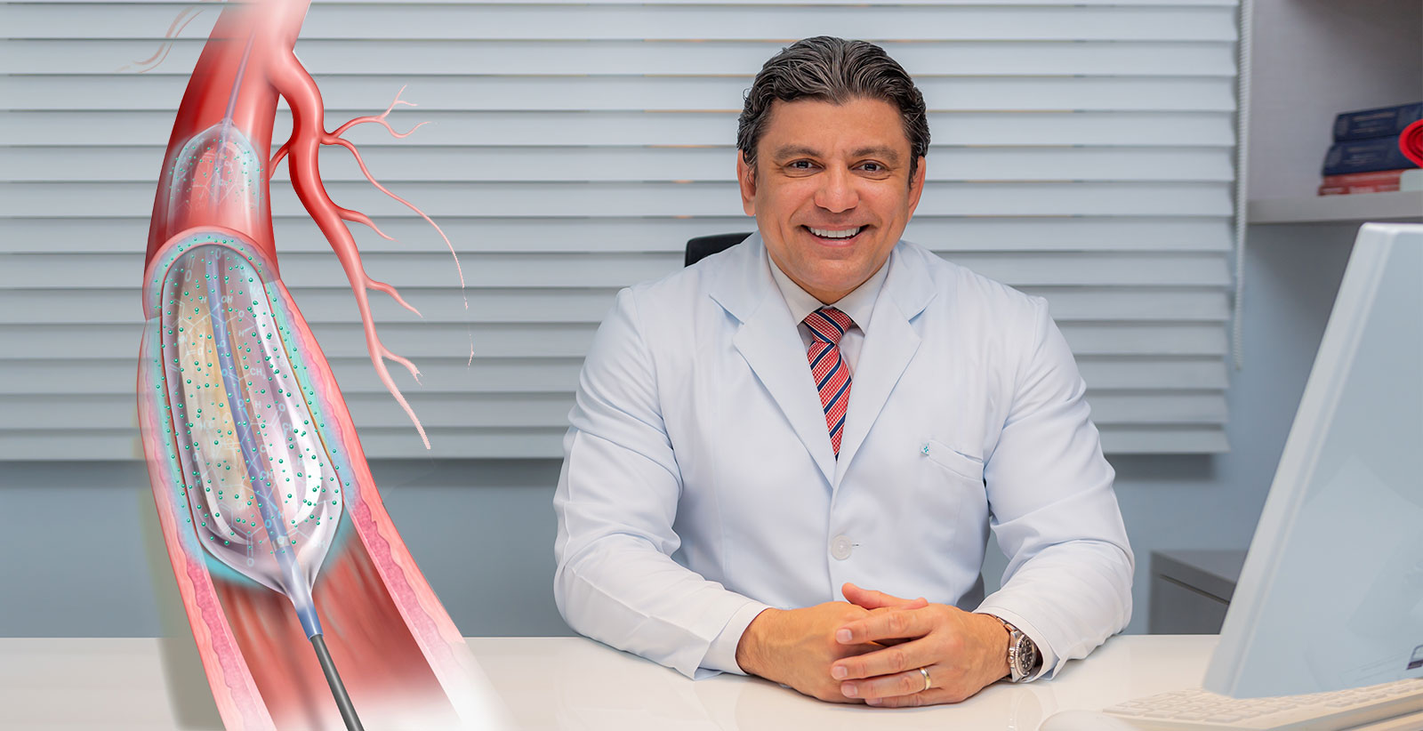 Angioplastia-em-manaus-dr-marcus-grangeiro